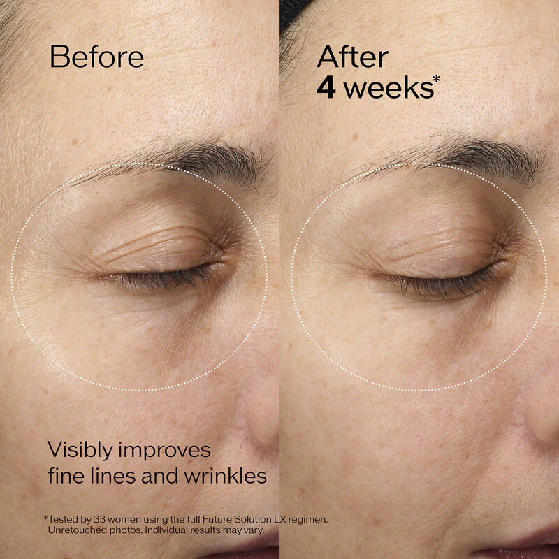 Shiseido Future Solution LX Eye and Lip Contour Regenerating Cream - Image 5